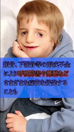 【奇病】実在する信じ難い奇病3選 #Shorts #雑学 #考察 #病気 #奇病 #閲覧注意