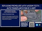 Replacing Premolars with Wisdom Teeth - Auto Transplantation by a GDP! - PDP193 • Video • MEDtube.net