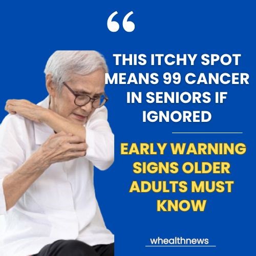 This itchy spot means 99 cancer in seniors if ignored. Early warning signs older adults must know | Wealthnews