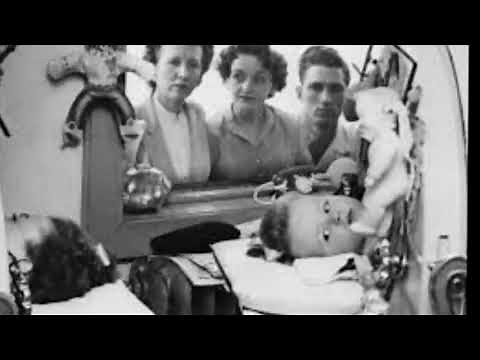 History of polio