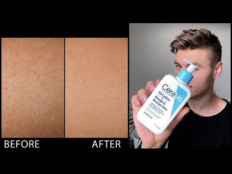 CeraVe SA Lotion for Rough & Bumpy Skin Review