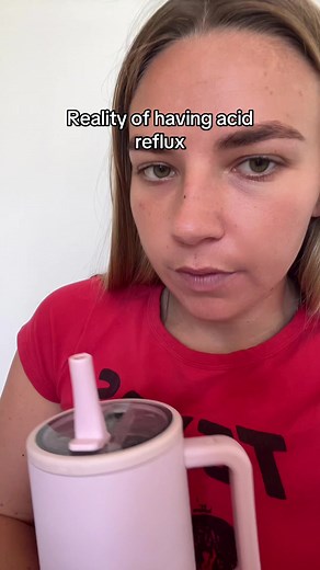 I MISS DIET COKE #REFLUX #GERD #ppi #acidreflux #burping | acid reflux