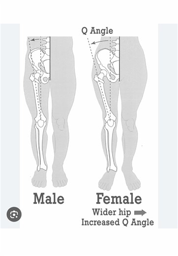 The Q-Angle & Knee Pain 🦵🏽 After puberty, many women develop wider hips, which can increase the Q-angle—the line of force from the hip to the knee. A larger Q-angle may place more stress on the knee joint, contributing to instability and anterior knee pain, especially when movement relies too heavily on the quads. The solution isn’t avoiding movement—it’s better movement. Engaging the feet, strengthening the hamstrings and glutes, and improving hip-to-knee control helps balance forces at the k
