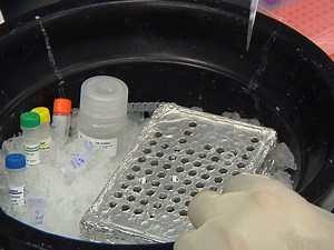 Cerebrospinal Fluid MicroRNA Profiling Using Quantitative Real Time PCR