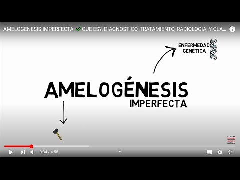 AMELOGENESIS IMPERFECTA ✔️QUE ES?, DIAGNOSTICO, TRATAMIENTO, RADIOLOGIA, Y CLASIFCACION.