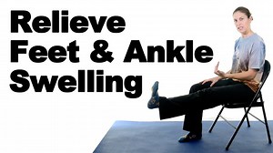 If you have swelling in your feet or ankles, this video may help. This type of swelling is usually from an injury, but it can be an injury at your foot, ankle, knee, hip, or even back since the fluid or swelling will often follow gravity. Want more videos like these? Subscribe to my YouTube channel: http://www.youtube.com/subscription_center?add_user=askdoctorjo | Ask Doctor Jo