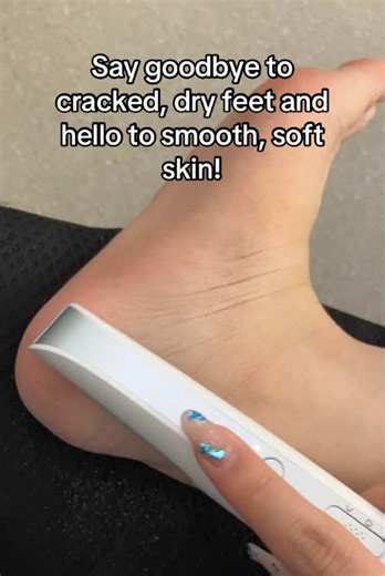 Powerful & Portable – this waterproof foot file easily removes dead skin, calluses, and rough spots in MINUTES! Perfect for at-home pedicures – smooth, silky feet WITHOUT the salon price! Waterproof & easy to use – get your feet ready for summer, all year long! Soft, smooth feet are just a click away! Don’t wait—treat yourself NOW! #FootCare #SmoothFeet #CallusRemover #PedicureAtHome #SummerFeet #BeautyHack #TikTokFinds #FootScrubber#personal #care #products