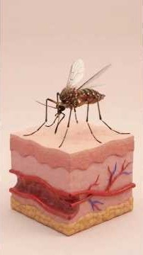 Life cycle of Malaria in short.