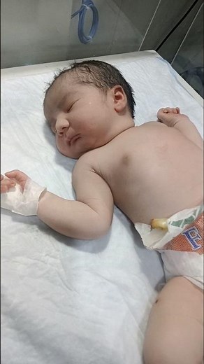 Newborn MSL Grade 1 with Birth Asphyxia 🩺👶 | NICU Emergency Care & Monitoring | Short