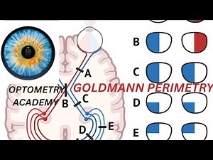 PERIMETRY: GOLDMANN PERIMETRY, PROCEDURE AND INTERPRETATION