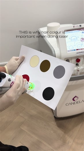 Did you know laser hair removal only works on brown or black hair? Blonde, red and white hairs don’t contain enough pigment, so they won’t respond to laser treatment. #gentlemaxproplus #candela #hausoflaser #hairremoval #laser