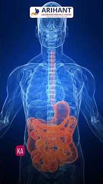 Inflammatory Bowel Disease (IBD) Explained | Crohn's Disease vs Ulcerative Colitis