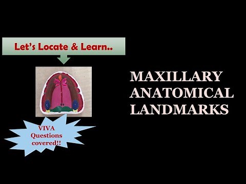 MAXILLARY ANATOMICAL LANDMARKS / MARKING ON MODEL / DENTURE BEARING AREA