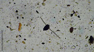soil microorganisms close up under the microscope. in a soil samlple from a farm