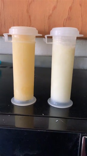 Colostrum vs Milk: Understanding the Differences