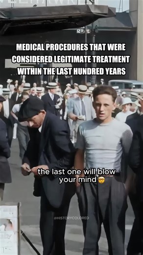 medical procedures that were considered legitimate treatment with in the last 100 years #facts #history #historyfacts #historytok