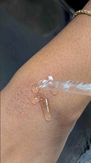 RAPID hydration of irritant dermatitis with hyaluronic acid and silicone