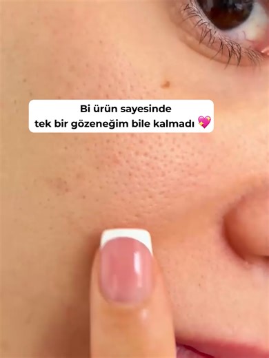 phlabzeroporetonerpad TikTok'ta