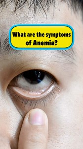 18K views · 168 reactions | What are the symptoms of Anemia? #anemia #health #science | Doctor ASKY | Facebook