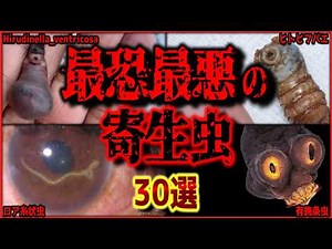 【閲覧注意】異常なまでの凶悪さ…実在する最悪の寄生虫 30選【ゆっくり解説/作業用BGM/睡眠用/9割が知らない】
