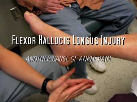 Flexor Hallucis Longus Strain