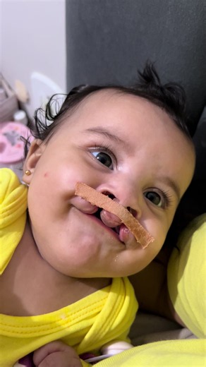 Eu tenho Kiko e posso provar — vídeo sobre fissura labiopalatina e Chaves