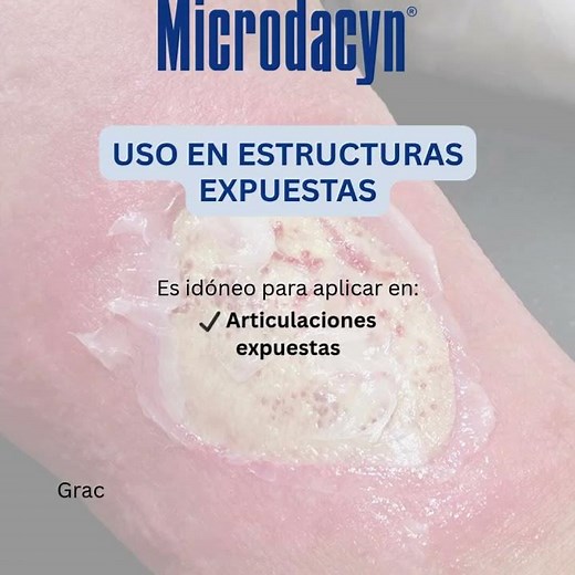 ¿Sabías que con Microdacyn...?