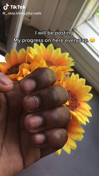 Nail biting journey day 1 💅🏾 #nailbiter #nailbitinghabit #fyp