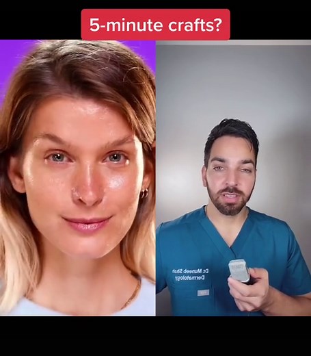 Skin Care Tips: Removing Blackheads & Sebaceous Filaments at Home