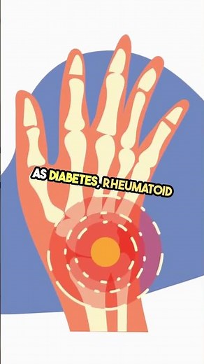 what can cause bone disease? #skeleton #fracture