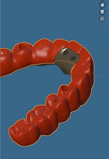 #blenderfordental #designer #designers #remote #remotedesign #remotedesigner #dental #dentalife #dentaltechnician #exocadworld #exocad #exocadgeek #exocadexpert #exocadexperts #exocaddental #exocaddesigner #exocaddentalcad #exocadtraining #exocadgalway #stomatology #dentist#teeth #crown #crowns #verners #dentaltechnology#waxup #waxups #waxupdental #waxupcourse