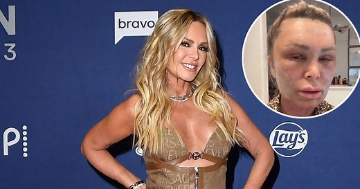 RHOC's Tamra Judge Looks Unrecognizable After Plastic Surgery