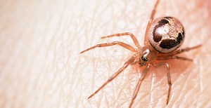 Dad Hospitalized After Spider Bite Gives Him Flesh Eating Bacteria