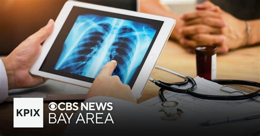 Bay Area lung cancer survivor recalls how car crash may have saved her life