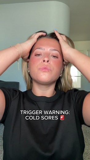 Effective Treatment for Cold Sores with Quantum Health Products