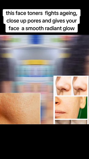 Effective Face Toners for Glowing Skin