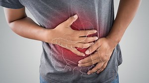 Doctor Recommends 7 Foods to Eat More Often as Colon Cancer Rises in Young Adults