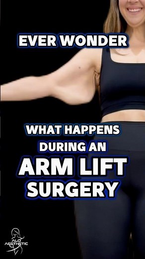 What happens during an arm lift surgery? Brachioplasty
