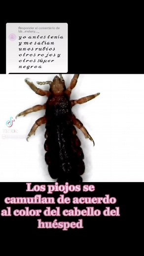 43K views · 454 reactions | Los piojos son de color gris, sin embargo al comer cambian de color, además se camuflan de acuerdo al color del cabello del huésped | Sin Pioquitos Eliminación de piojos y liendres Uruapan | Facebook