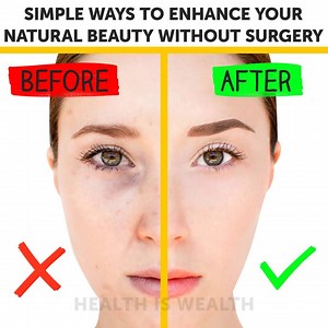 83K views · 170 reactions | Simple ways to enhance your natural beauty without surgery: | You're Gorgeous | Facebook