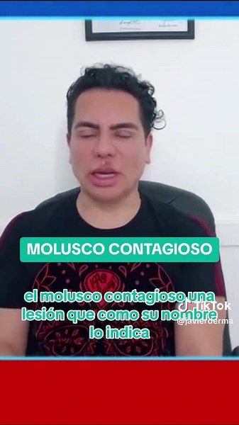 Tratamiento de molusco contagioso en la piel | Dermatología Infantil