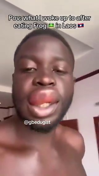Can’t even eat some kind of birds in lagos and someone’s digesting a whole frog?😭