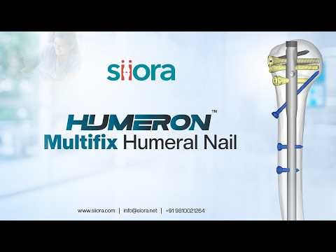 Product Information of HUMERON Multifix Humeral Nail | Siora Surgicals