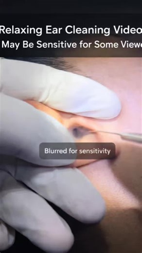 "Viewer discretion advised: Some visuals may feel slightly uncomfortab...