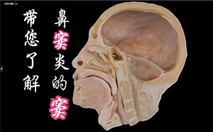 带您了解：鼻窦炎的窦