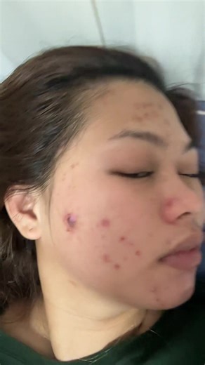 Understanding Scarsheets: Uses and Benefits