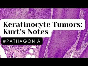 Keratinocyte Tumors: Kurt’s Notes #pathagonia