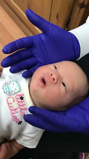 Lip Exercises and Stretches