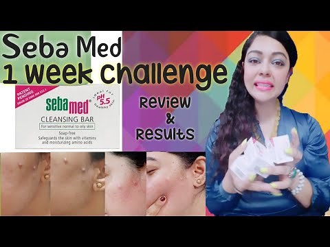 Sebamed Soap for Skin Irritation, Rashes and Acne. 7 Days Pictorial Demonstration & Review.