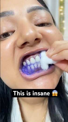 Purple toothpaste for teeth correction